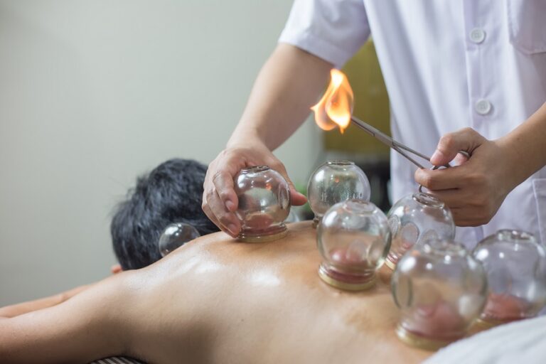 Cupping therapy Melbourne