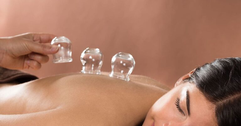 cupping therapy melbourne