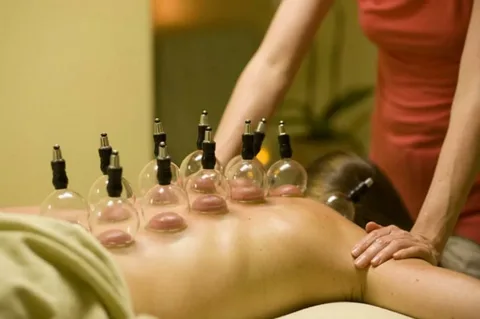 A Complete Guide to Cupping Therapy Melbourne and Dry Needling Treatment