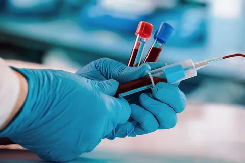 Live Blood Analysis Melbourne Treatment Can Benefit Patients In Many Ways!