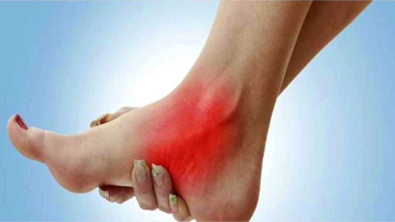 shoes for cuboid syndrome